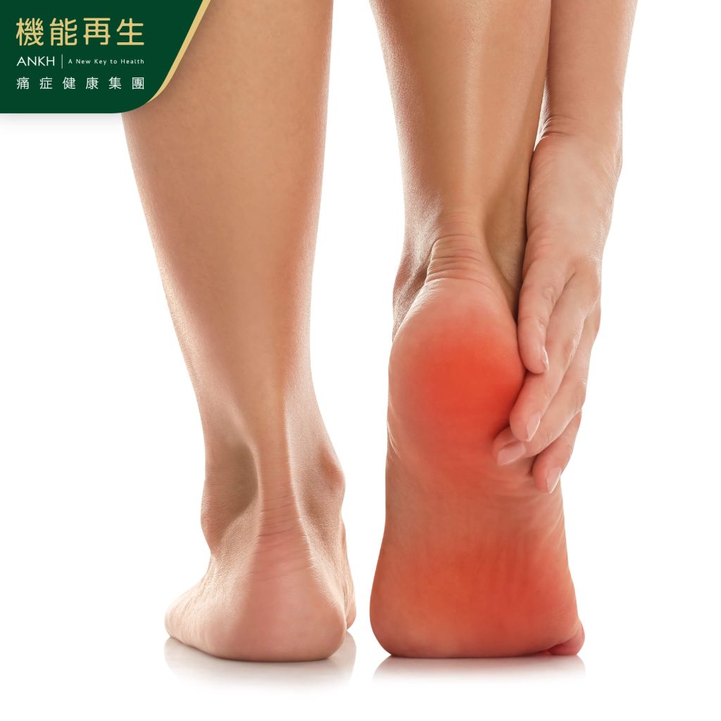 足底筋膜炎症狀-腳板底中間及腳跟痛-ANKH機能再生