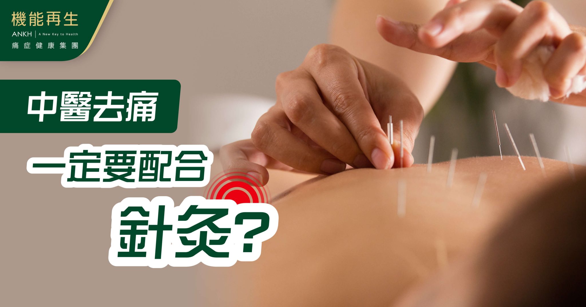 【針灸】原理揭秘,注意事項全解析:功效、後遺症、價錢一覽無遺,針灸是去痛唯一方法?分析中醫配合科技的趨勢。(2025年專家意見)