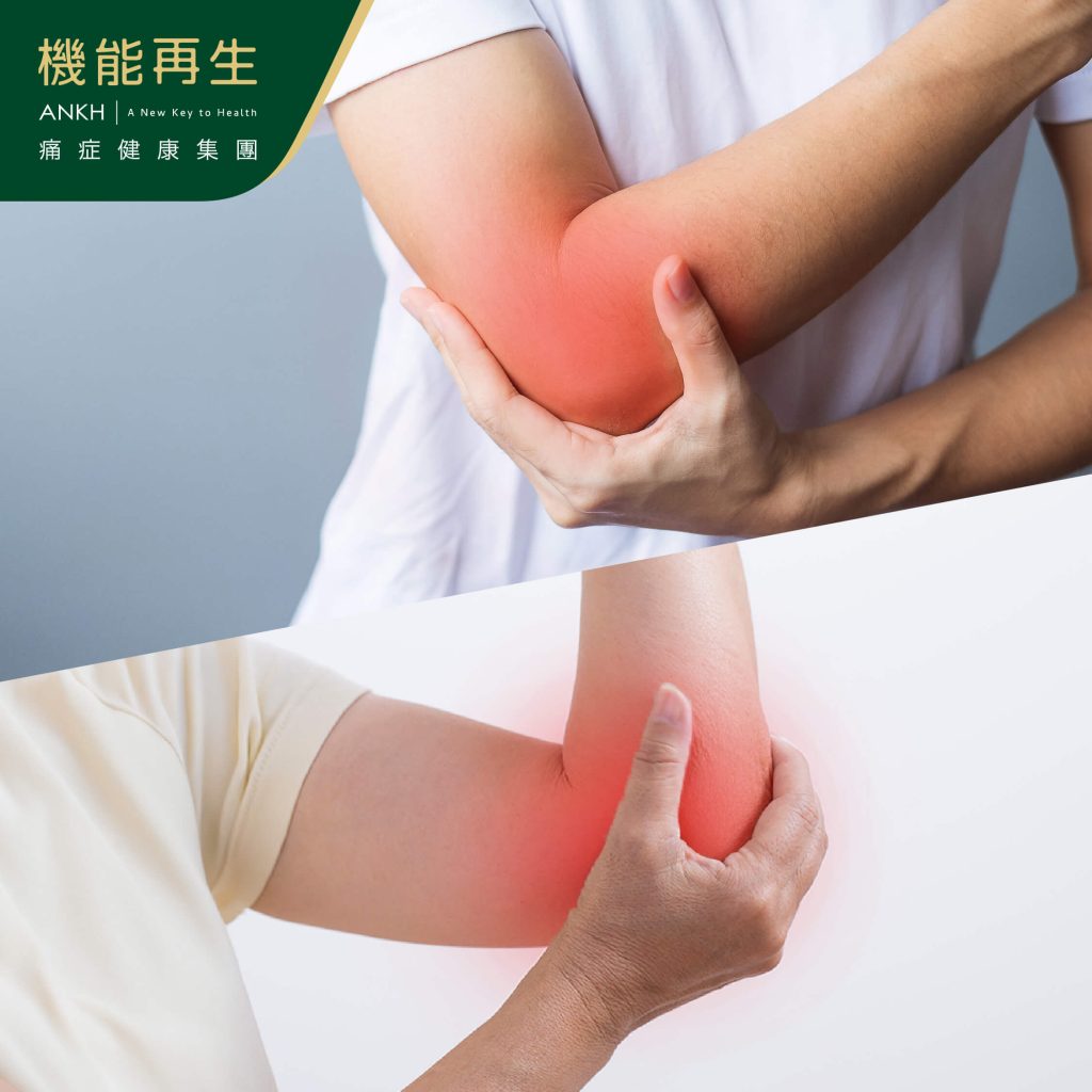 手肘外側痛、內側痛原因-ANKH機能再生