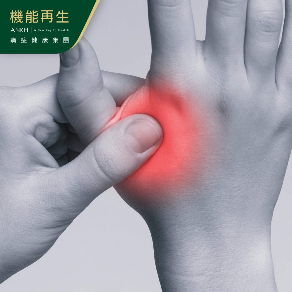手指是類風濕關節炎常見的位置-ANKH機能再生