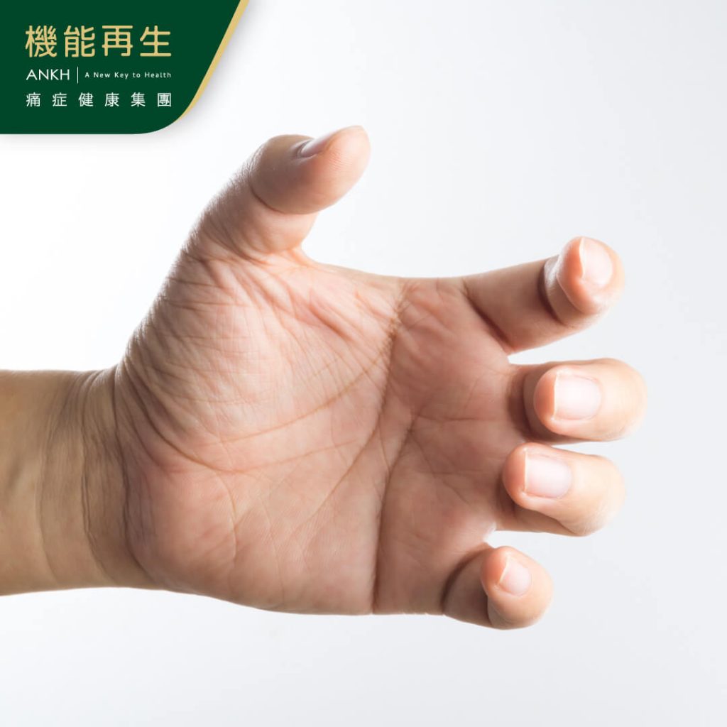 有媽媽手的其中一個常見症狀是手的握力和指力會大幅減少-ANKH機能再生
