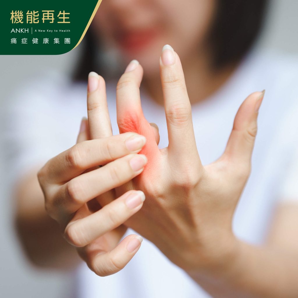 痛風成因與新陳代謝有莫大關係，常見於手指關節-ANKH機能再生