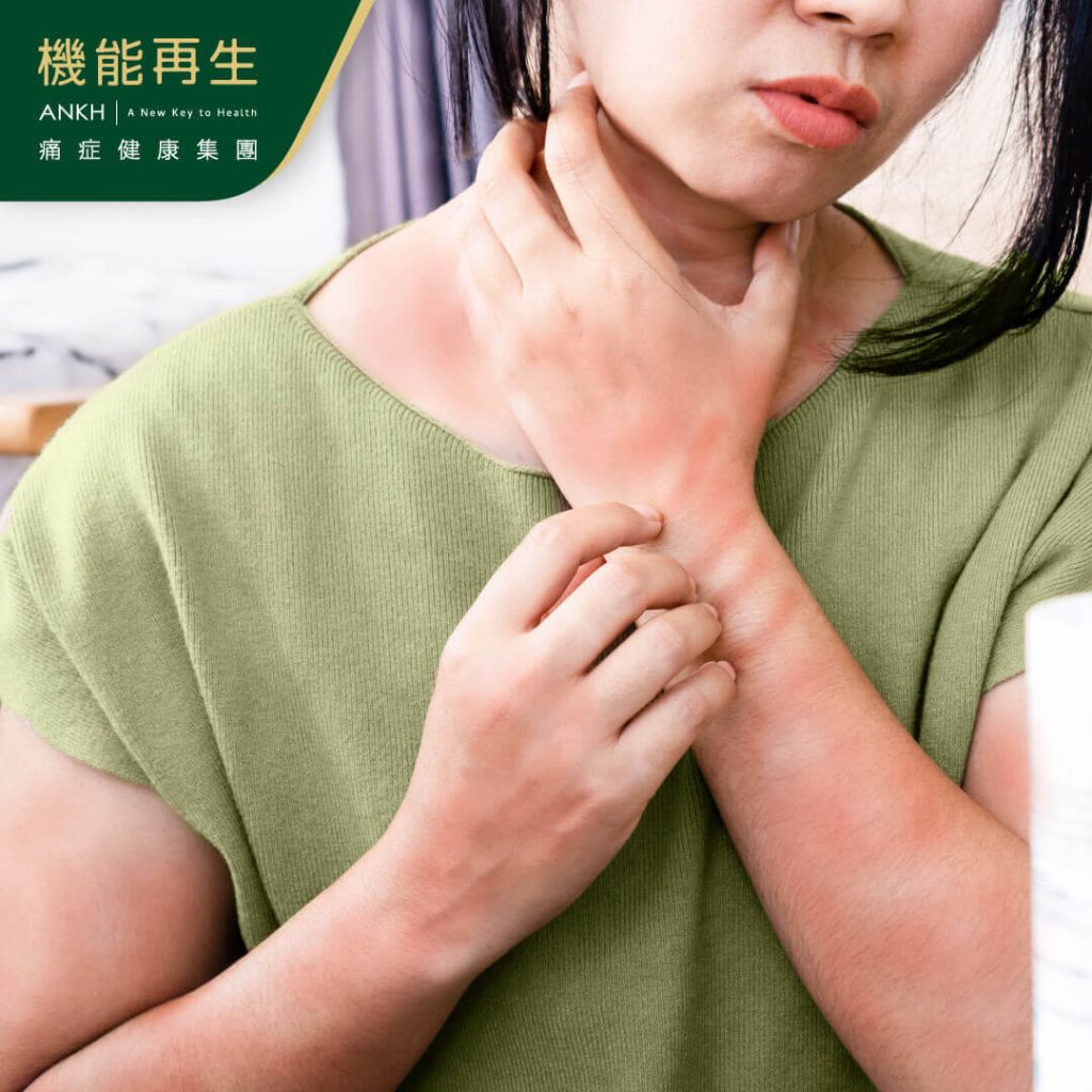 手背、臉部、嘴唇、腋下、手肘窩、膝窩、陰部、前胸等部位都是異位性皮膚炎發作的可能部位-ANKH機能再生