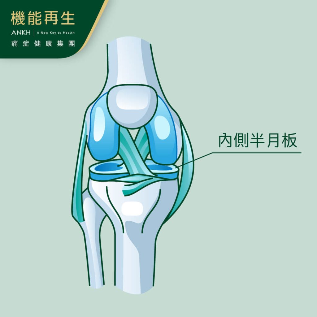 半月板具有緩衝作用-ANKH機能再生