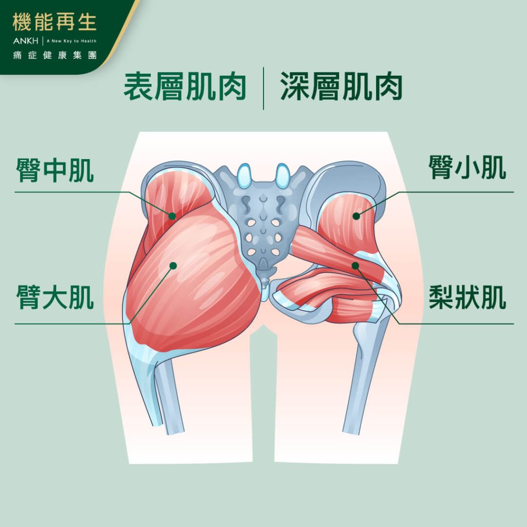 臀大肌、臀中肌及臀小肌肌力不足、受傷或發炎會令梨狀肌發炎的機會增加，形成梨狀肌症候群。-ANKH機能再生