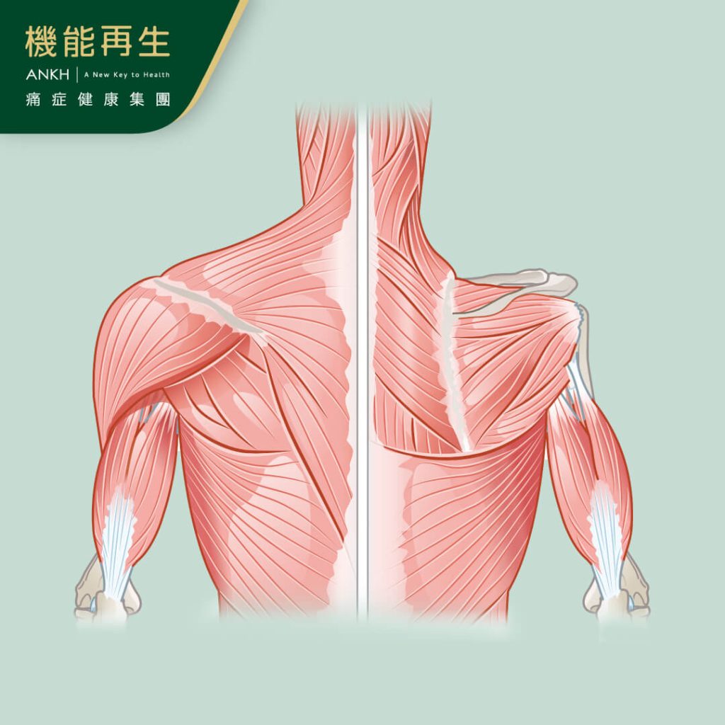 小心肩膊肌腱發炎-ANKH機能再生