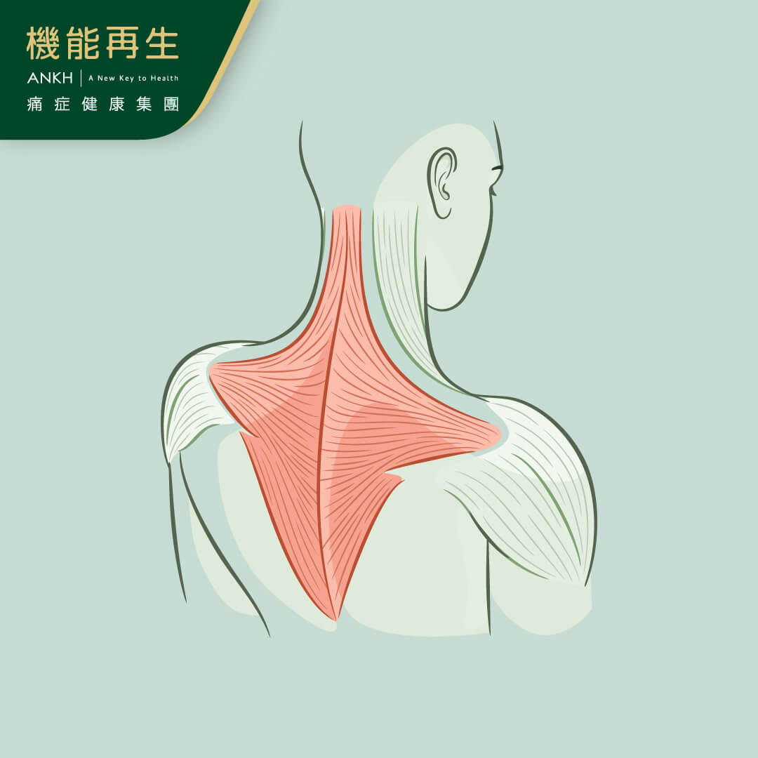 【背痛位置大揭秘】拆解上、中、下、左、右背痛原因，推介6舒緩方法。